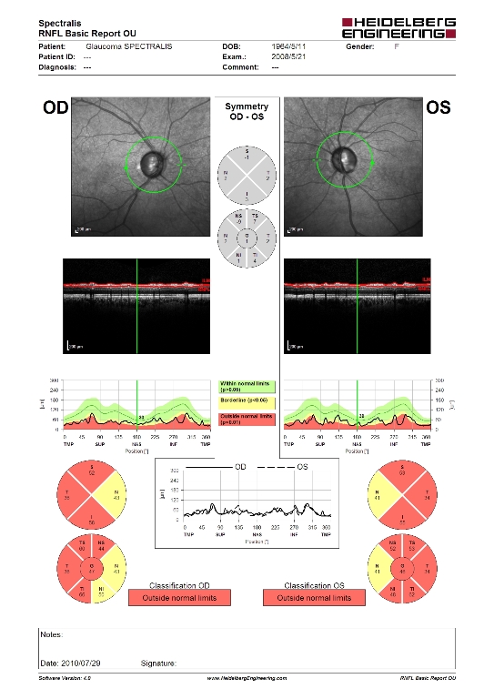 図1）視神経繊維層の厚みを測定出来るOCT